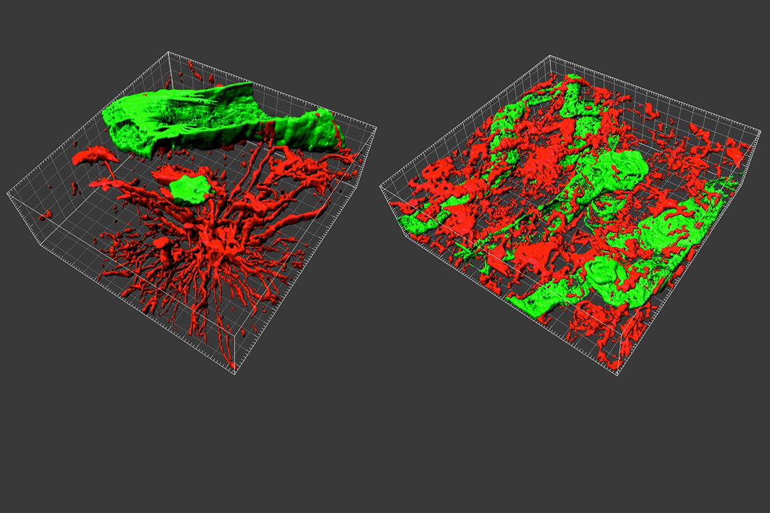 Biòpsies en 3D per entendre millor els tumors cerebrals